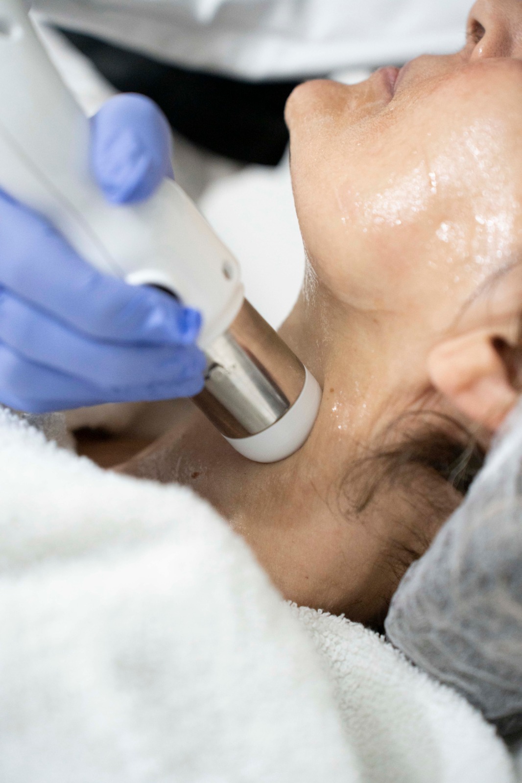 Ультразвуковой CFU ÈLIFE (HIFU)